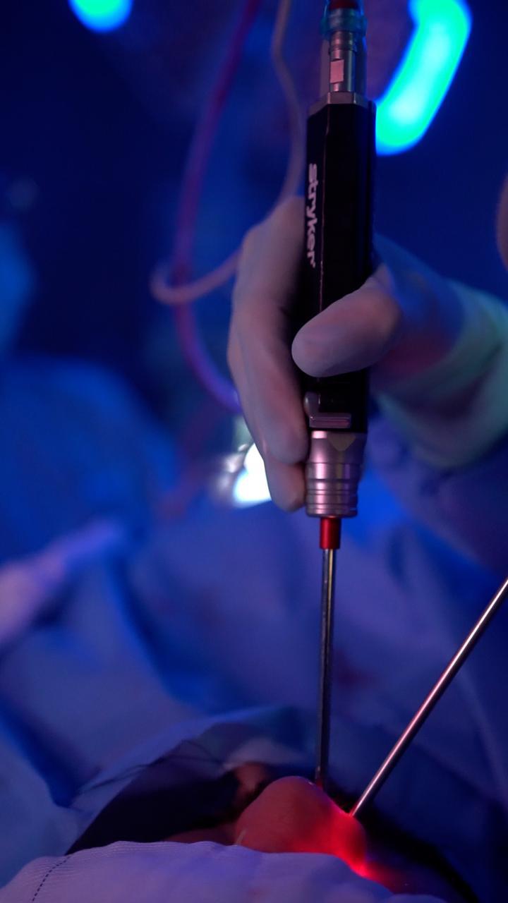 Instrumentação utilizada durante cirurgia endoscópica nasal