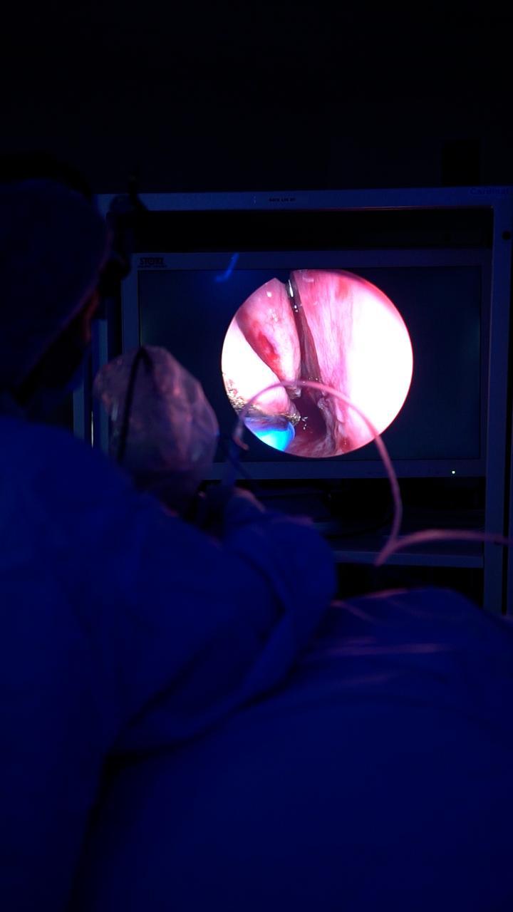 Visualização endoscópica durante cirurgia nasal